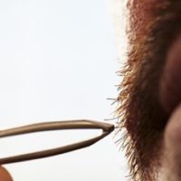 Poils incarnés de barbe : comment s’en débarrasser ?