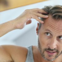 Calvitie : la poudre densifiante pour cheveux, une solution efficace ?