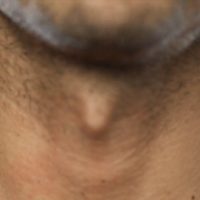 Comment correctement raser la zone de la pomme d’Adam ?