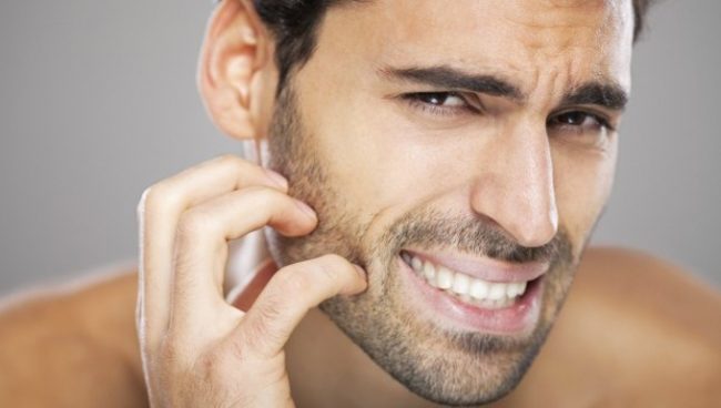 barbe qui pique