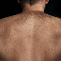 Épilation du dos : comment faire ?